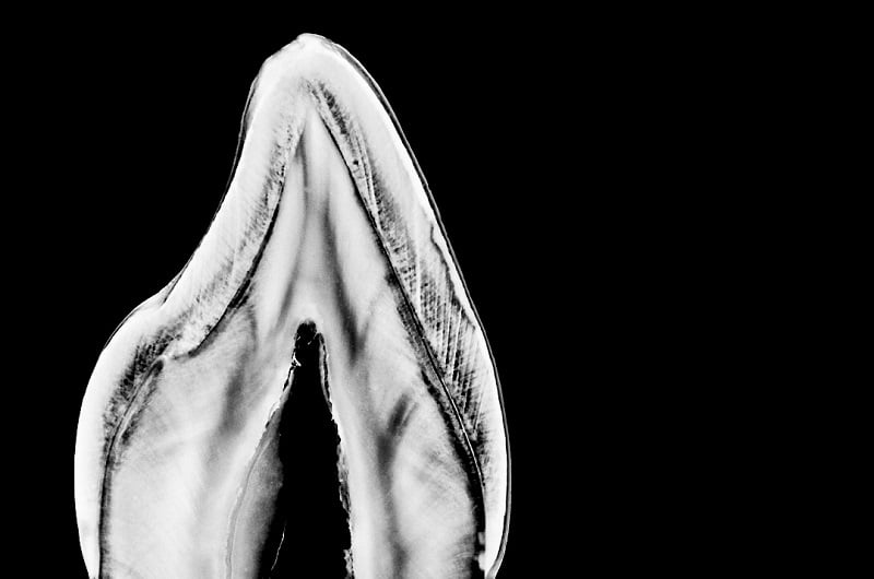 Teeth Art 5