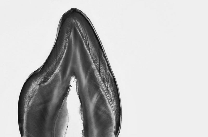 Teeth Art 4