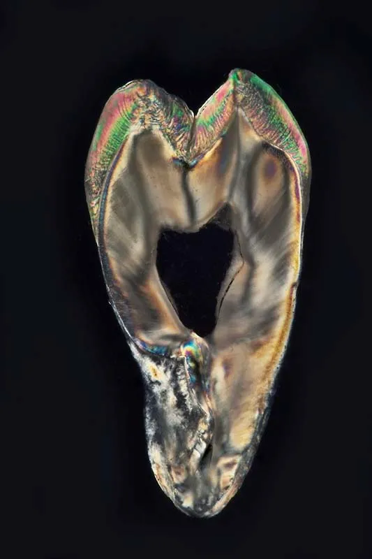 Teeth Art 8