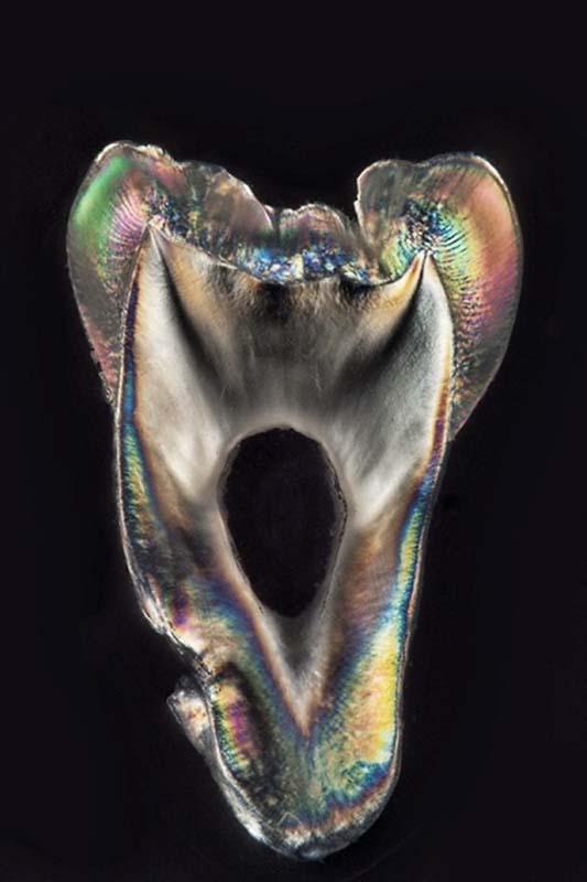 Teeth Art 9