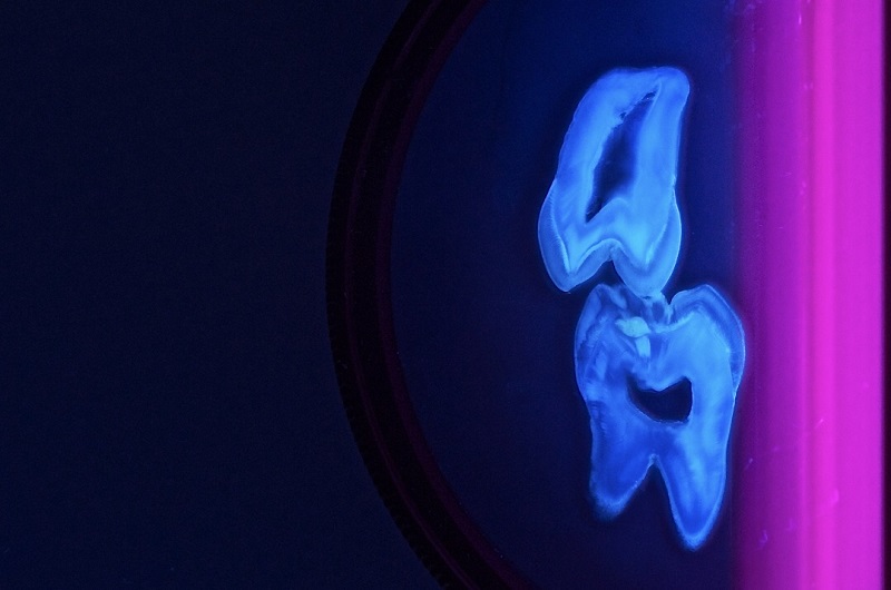 Teeth Art 6