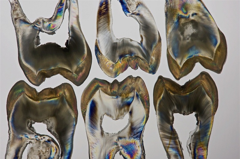 Teeth Art 1