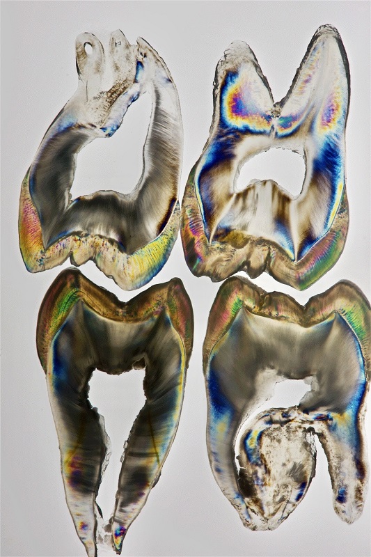Teeth Art 12