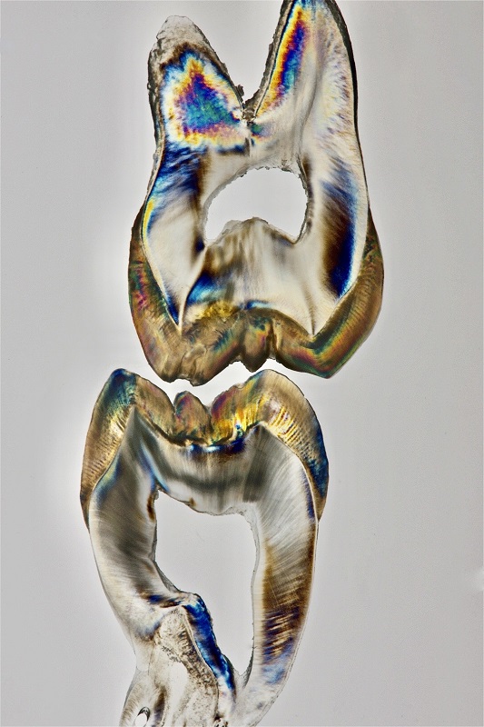 Teeth Art 11