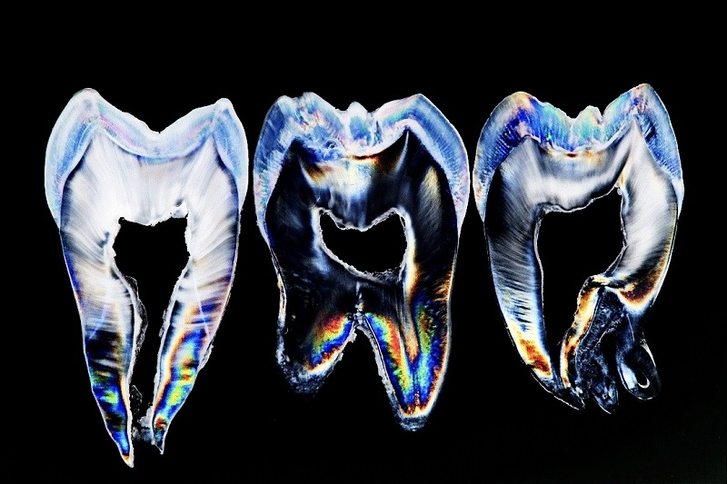 Teeth Art 3