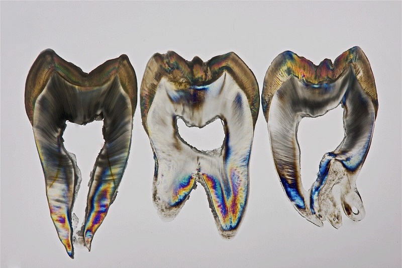Teeth Art 2