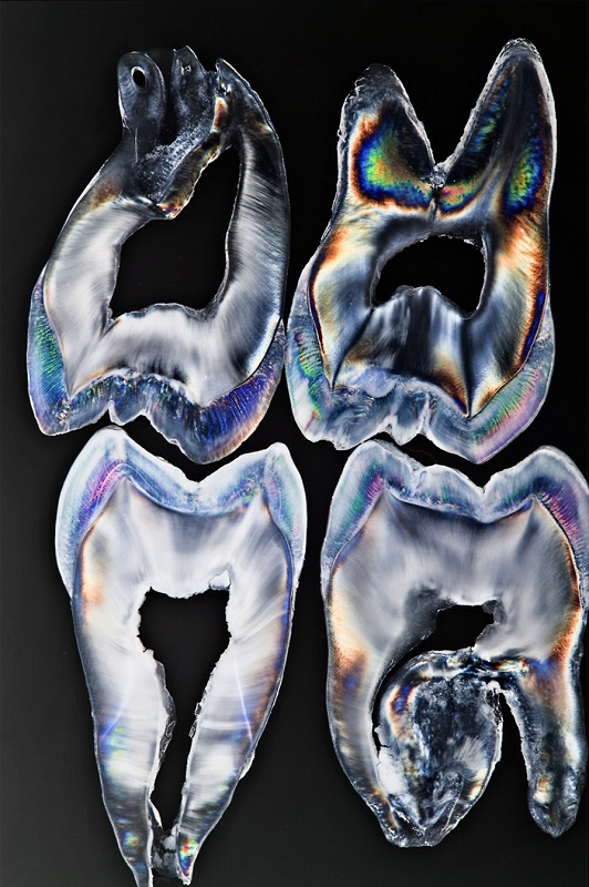 Teeth Art 7